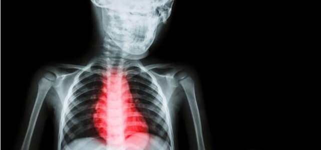 心脏|六个异常都说明一件事:你的心脏不行了!可大可小