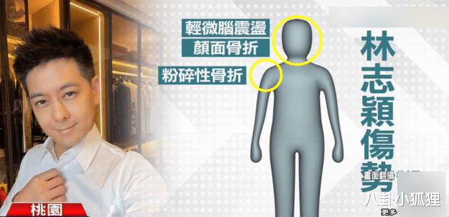 林志颖|台媒曝林志颖治疗进程：进行第二轮手术，林家将向施救者发感谢金