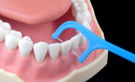疾病|我们为什么需要牙线?