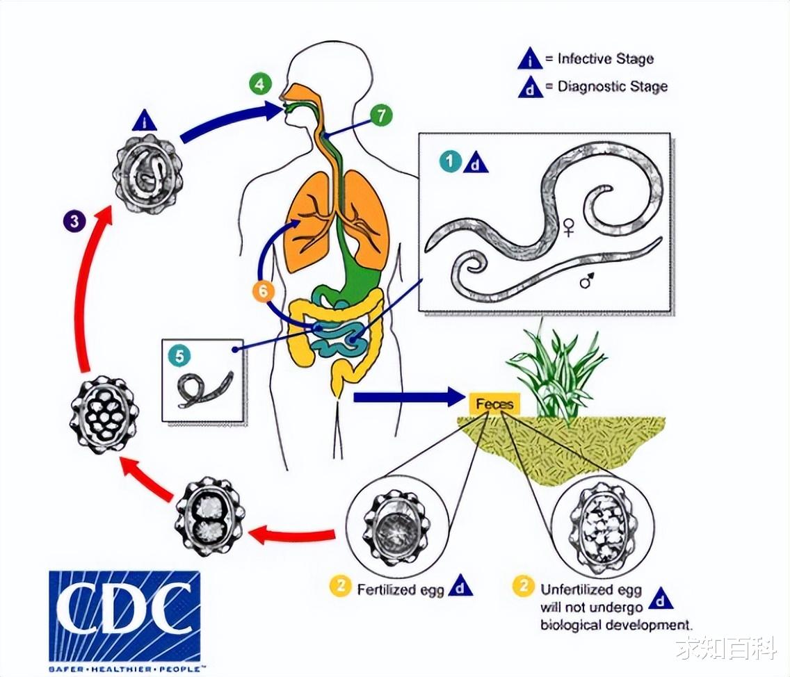 感染率曾高达70%,科学家以身试吃,在“盛宴”中推进的蛔虫研究