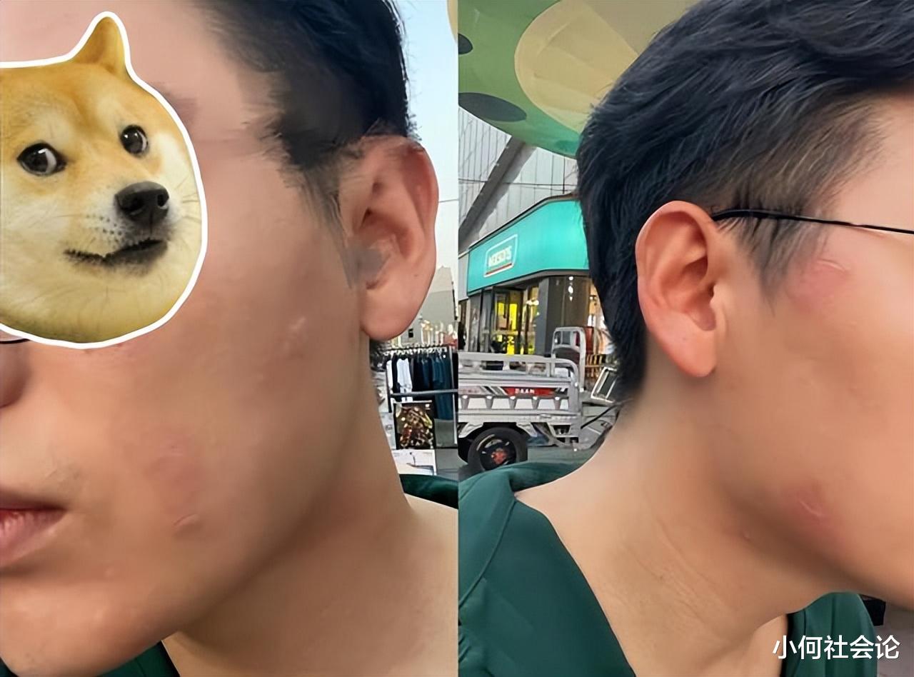 河北:男子喝蜜雪冰城绿茶后过敏,上门讨要说法,网友评论却一面倒