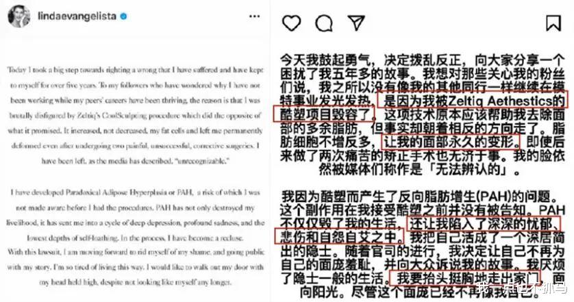 毁容|昔日「传奇美人」被「毁容」，是谁害了她？