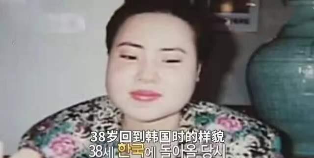 王一博|女星韩慧景:为了更漂亮,给脸注射食用油,把脸整成“猪头”