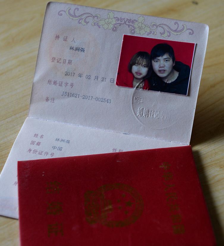 四川无鼻女孩:出生29天被老鼠咬掉鼻子,2017年和帅小伙网恋闪婚