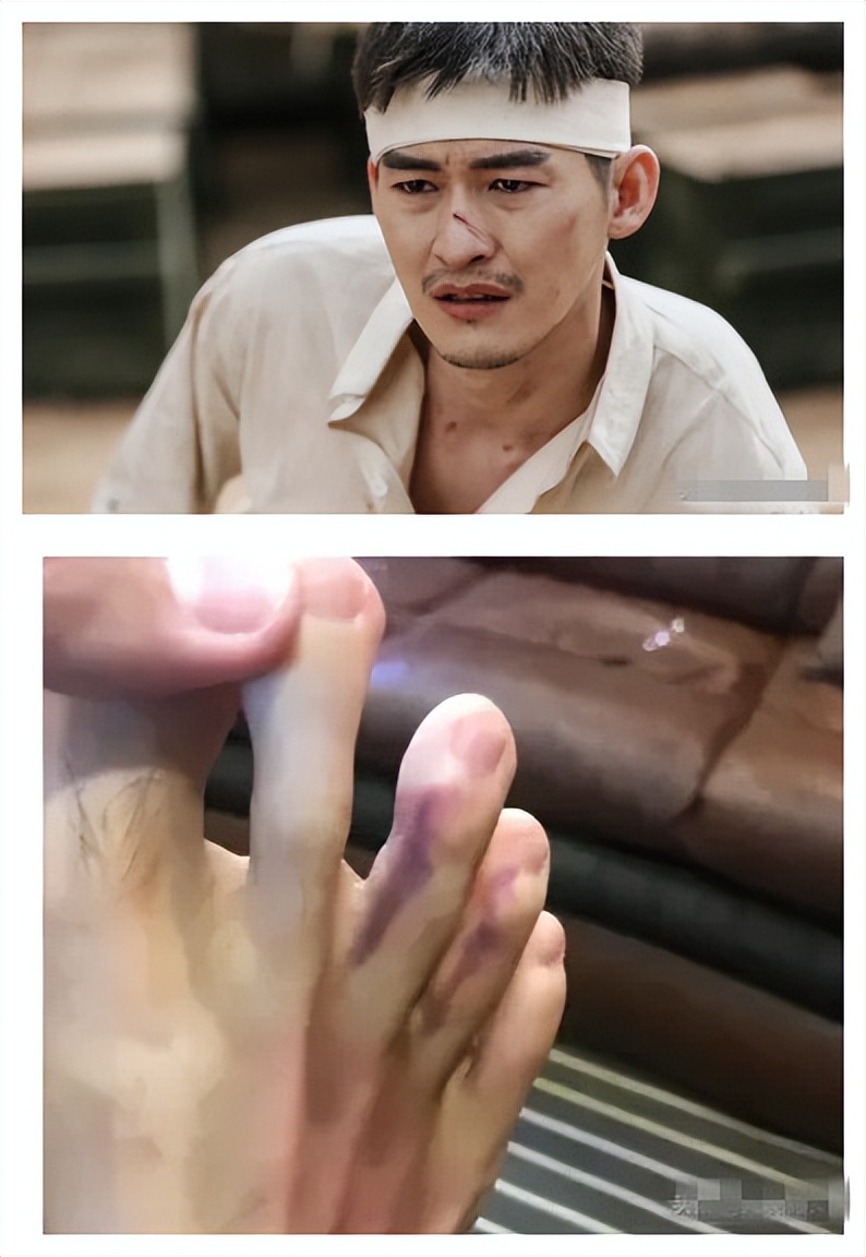 张翰|第一次有演员晒拍戏受伤引网友集体共鸣 张翰了不起啊