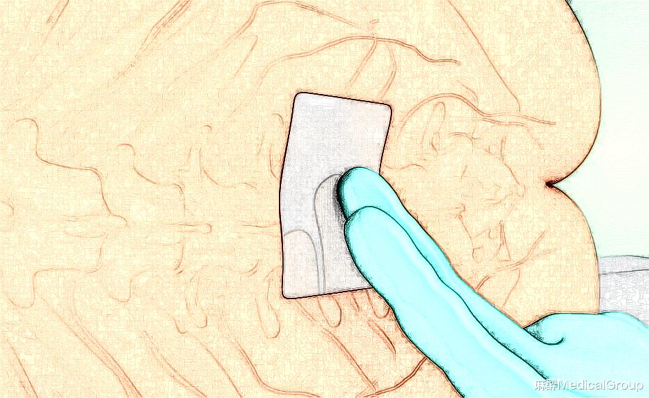 医生|手术结束后,她感觉似乎躺在水里,浑身冰冷冰冷的