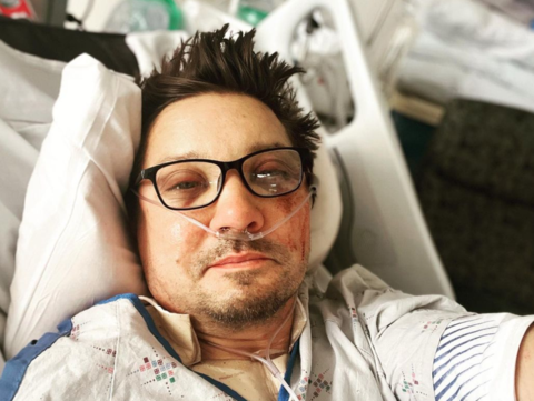 “鹰眼”扮演者晒出ICU自拍:躺病床上吸氧 面部憔悴淤血明显!