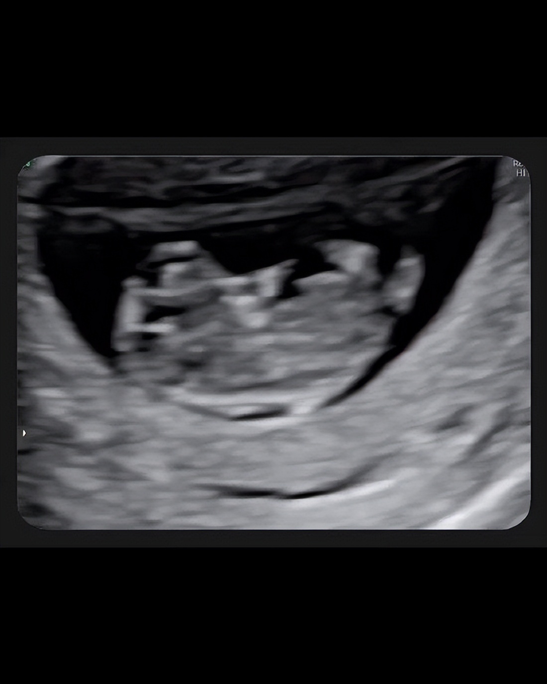 吴宗宪|吴宗宪大女儿晒B照，低调官宣已怀孕五个月，吴宗宪今天刚知道