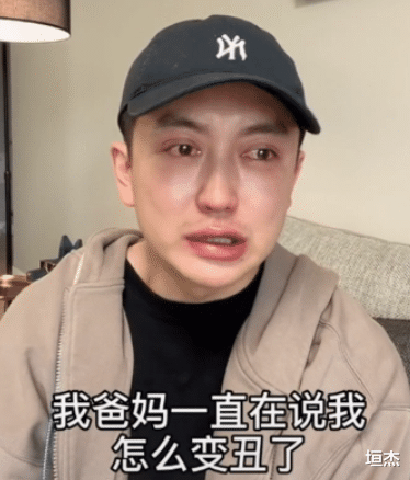 整容|网红金大威：哭诉整容失败史，小鲜肉变沧桑大叔，到底是谁害了他