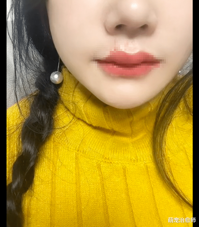 女士在救助流浪狗时，被狗狗误咬伤了嘴巴，她还坚持伤痛继续救！