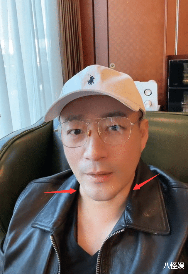 汪小菲|汪小菲新冠痊愈复工，嗓子沙哑脖子上肿包明显，身体状况令人担忧