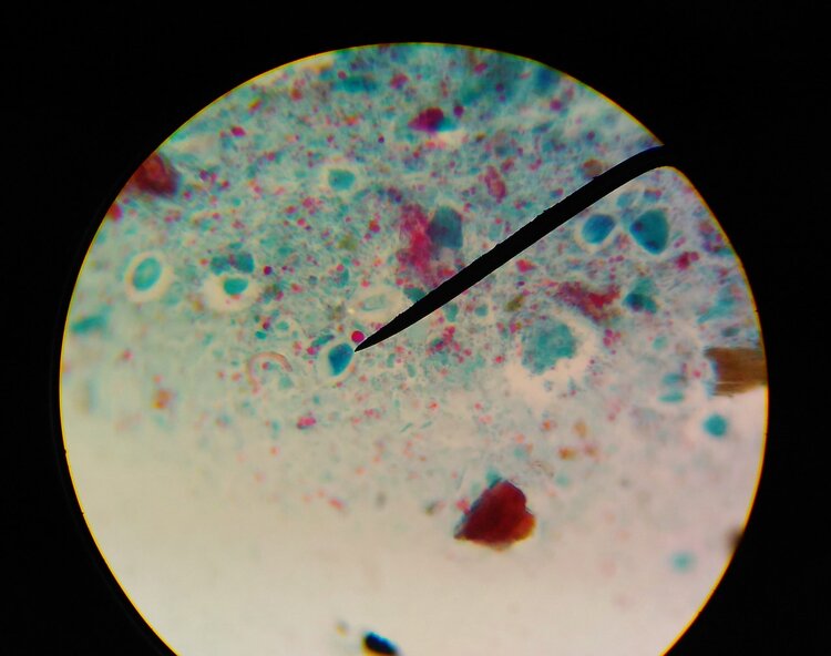 火锅|再次提醒:5种食物是寄生虫的“重灾区”,宁愿不吃,也要少碰