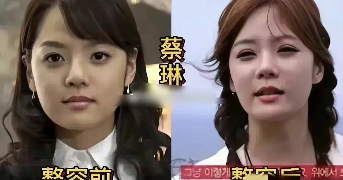 |原来这些韩国明星都整过容。