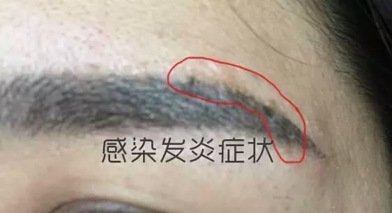 血糖 为什么有钱人不纹眉？那些纹眉的人有什么变化？内部人员讲出真相