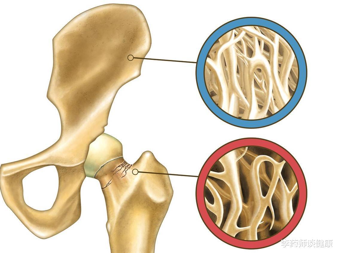 衰老|随着年龄增长,老年人将面临8大健康挑战,如何应对?一一说清