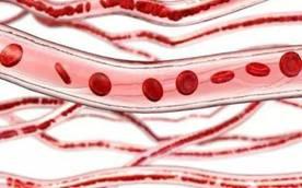 阿尔茨海默病|血管光滑,寿命长?中医:谨记5行为,血管不堵塞有弹性