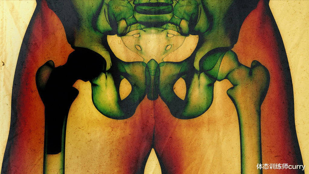 股骨头坏死|身体出现哪些特征,要小心股骨头坏死?常见的治疗方式有什么