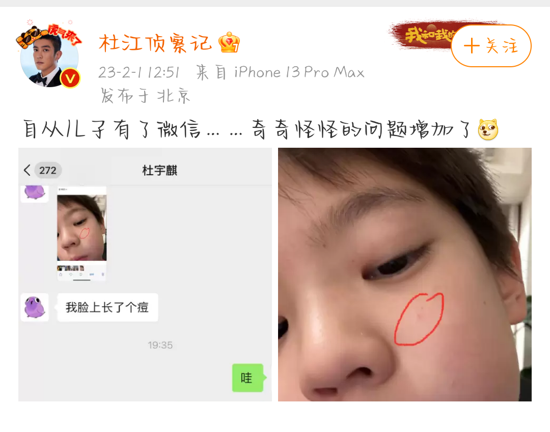 杜宇麒|杜江晒与儿子聊天记录，9岁嗯哼长青春痘好苦恼，用的头像好可爱