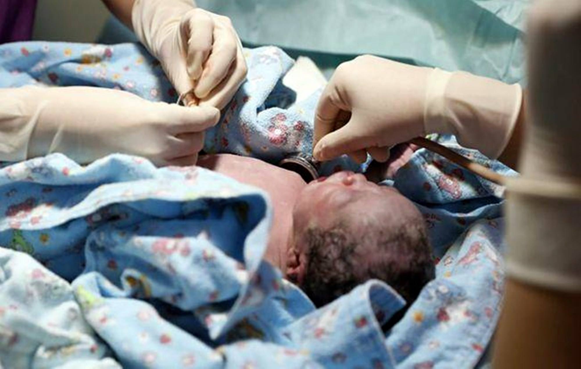 杨萍|她7岁停止生长，32岁貌似孩童，嫁给袖珍老公，如今生活幸福吗？