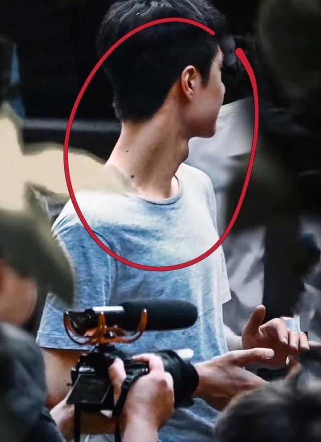 王一博|王一博拍戏“浑身是伤”！脖子后面淤青，不怕疼改革群演打闹