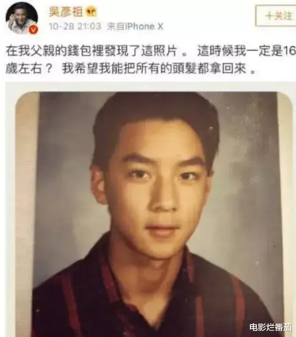 发际线|“秃顶”危机的10大男神，有人29岁发际线堪忧，有人常年戴假发套