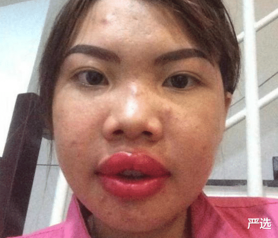 丑姑娘花9万元整容成功嫁富二代,生下孩子后被抛弃,现状如何?