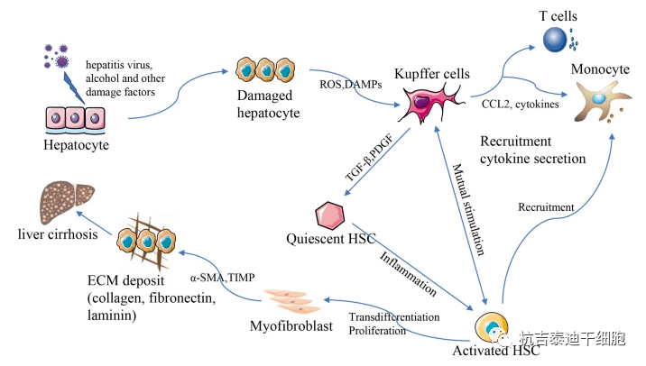 临床研究多达66项，间充质干细胞移植成为治疗肝硬化的新希望！