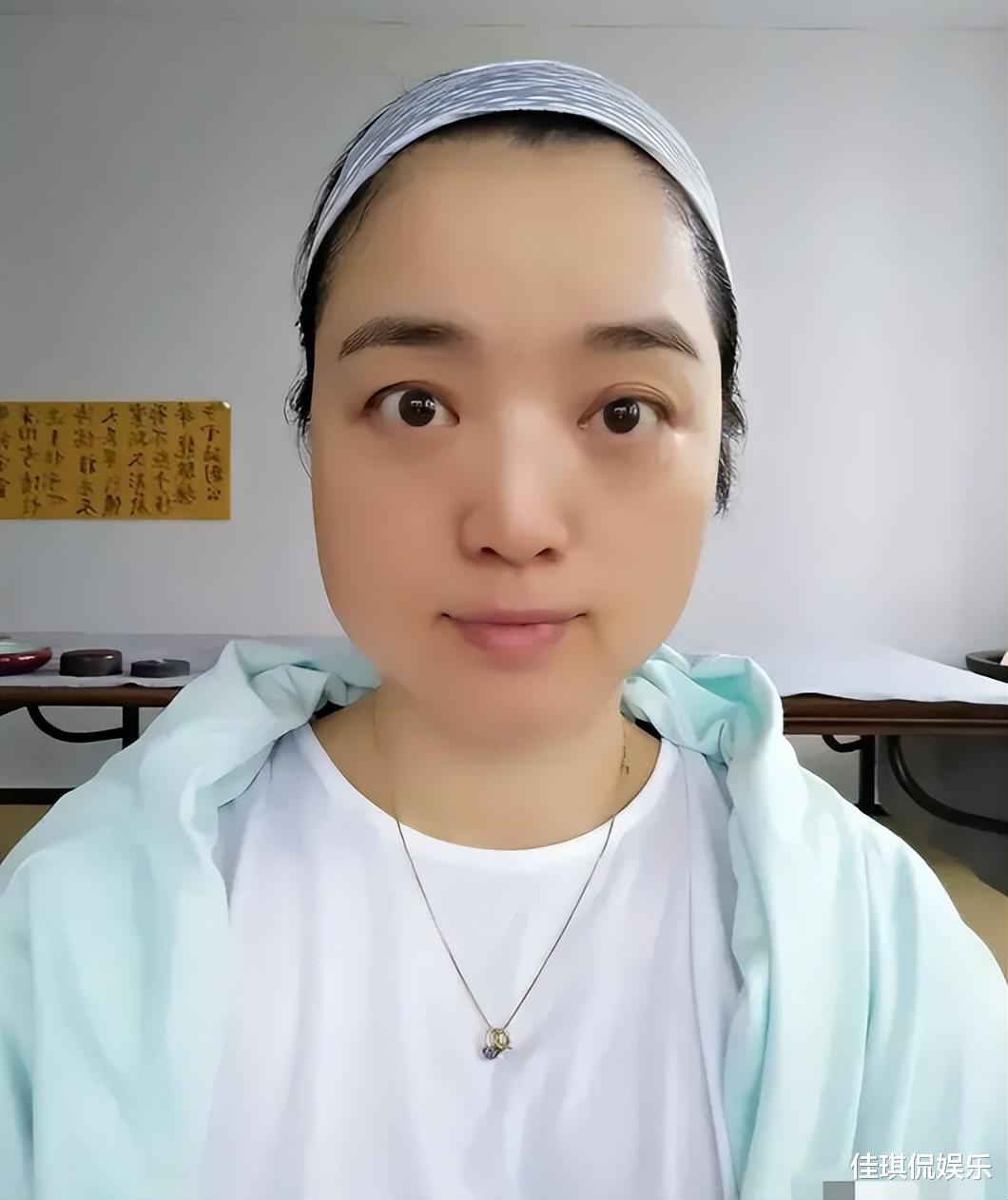 郭雪芙|歌手白雪对自己的脸型不满意,所以去做针灸,做拉伸,希望自己能变美!