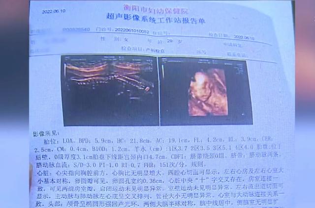 酒店老板出轨女员工,原配豪掷300万堕胎费被拒!