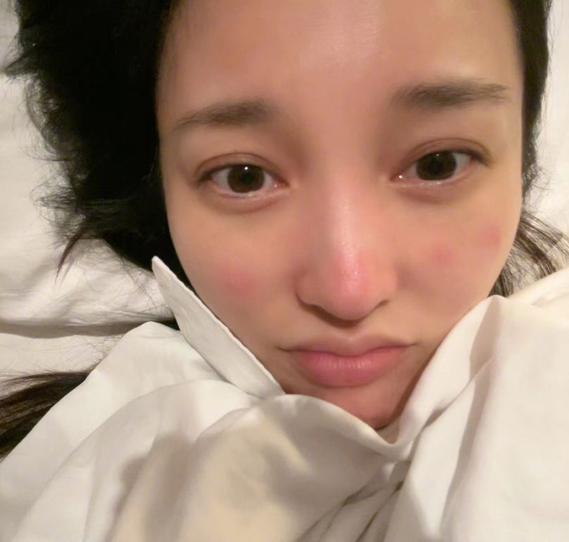 金莎|金莎确诊后露面报平安,贴着药膏一脸疲态,称头疼咳嗽喉咙不舒服