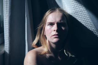 痘痘 20岁+3个常见美容护肤小贴士