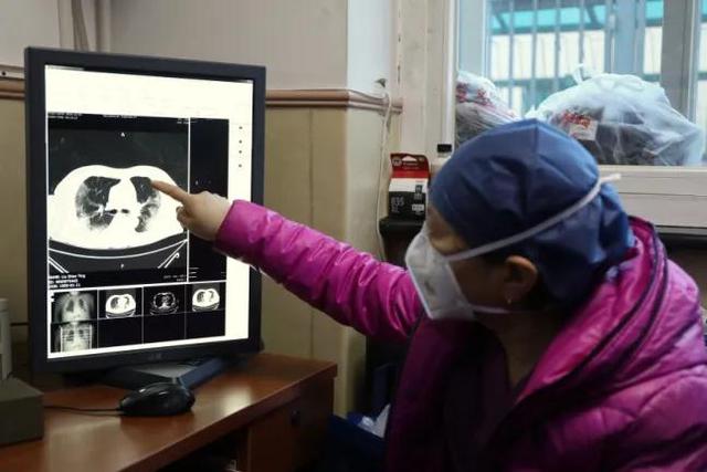 ct检查|肺部CT检查需求暴增,专家:肺炎实际检出率约10%-20%