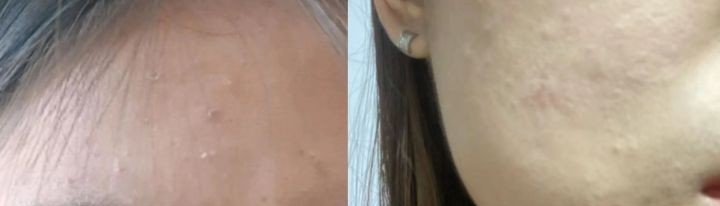 达达 别被忽悠了！用完卡粉脱妆甚至烂脸的孕期化妆品，宝妈还在囤？