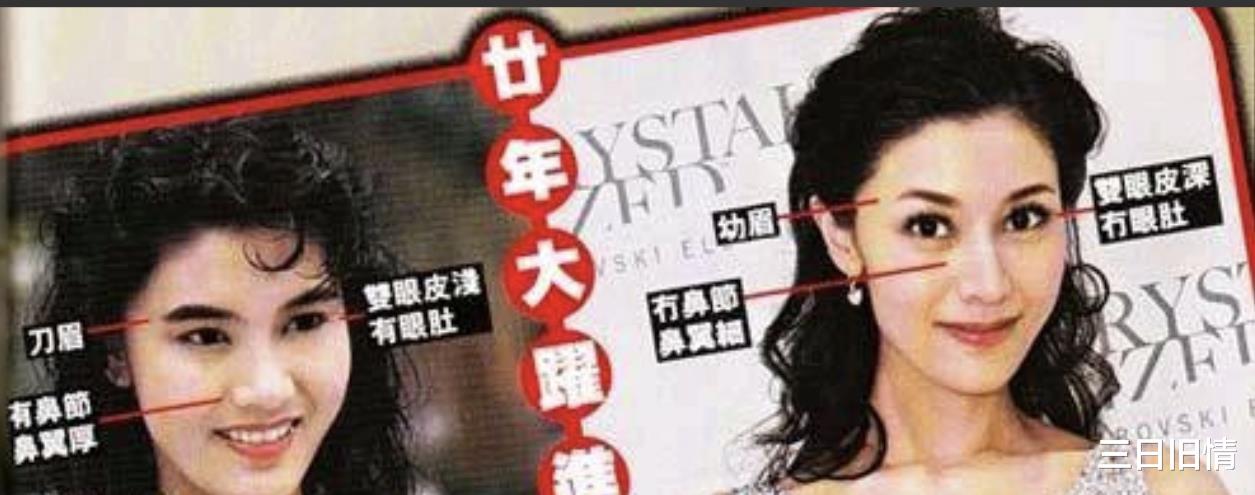 整容风也刮到了香港,这8位港圈大美人竟跑去DO脸,结局一言难尽
