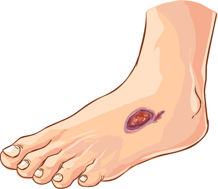 疾病|不是脚部衰老，而是疾病信号？脚部出现6种异样，或是身体的警报