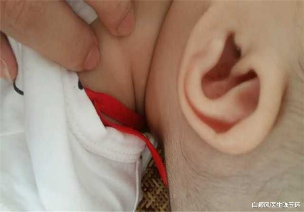 饮食|白癜风秋冬季饮食攻略