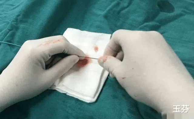 安倍的尸检结果出来了！其死亡的真正原因我们只猜对了一半