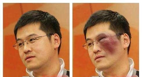杨毅|杨毅直言哈登不会被交易，如今被打肿脸为何？