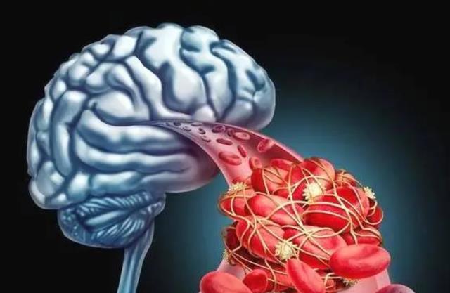 肩周炎|55岁男子,深夜脑梗瘫痪,提醒中老年人:晚饭后3件事要少做