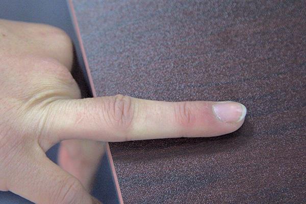 肝脏|肝脏损伤看看中指或能知道,若两处出现变化,就要注意保养肝脏了