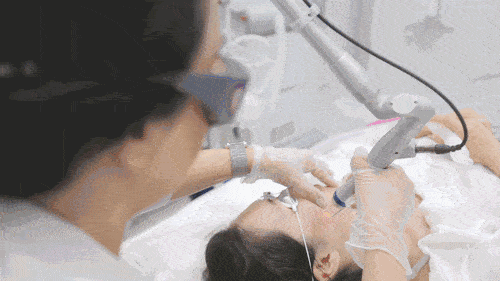 |那些从不长痘的人,到底做了啥?