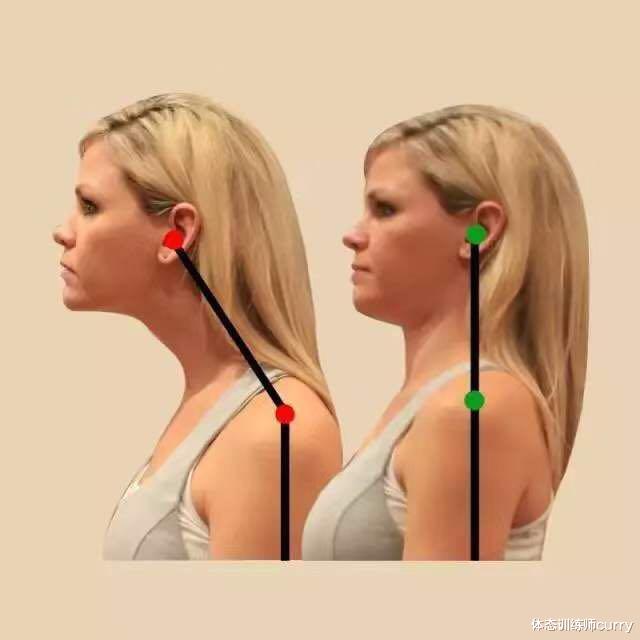 驼背|驼背,圆肩,头前引=显丑没气质?练这3类动作,让你逆袭气质女神