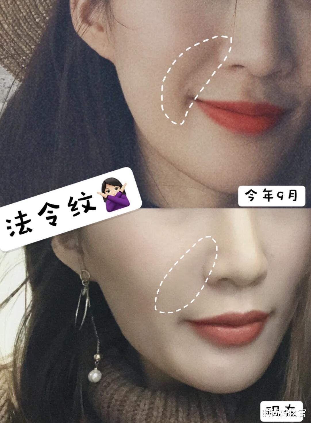 香蕉 一叶子、韩后等面膜纷纷差评,10款产品中唯一好评是它!