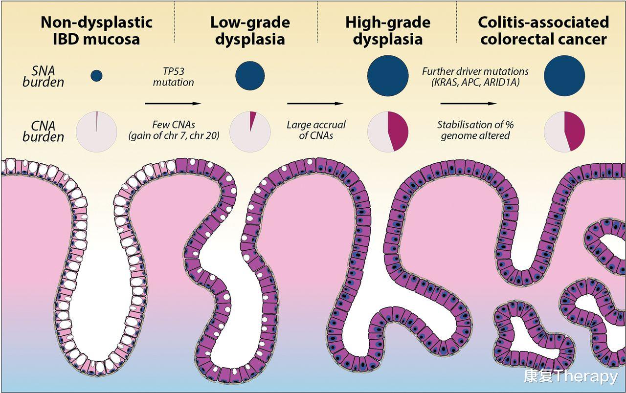 健脾祛湿|随访3万人发现,每天3杯茶,就能预防胃癌?医生提醒:2类茶无效
