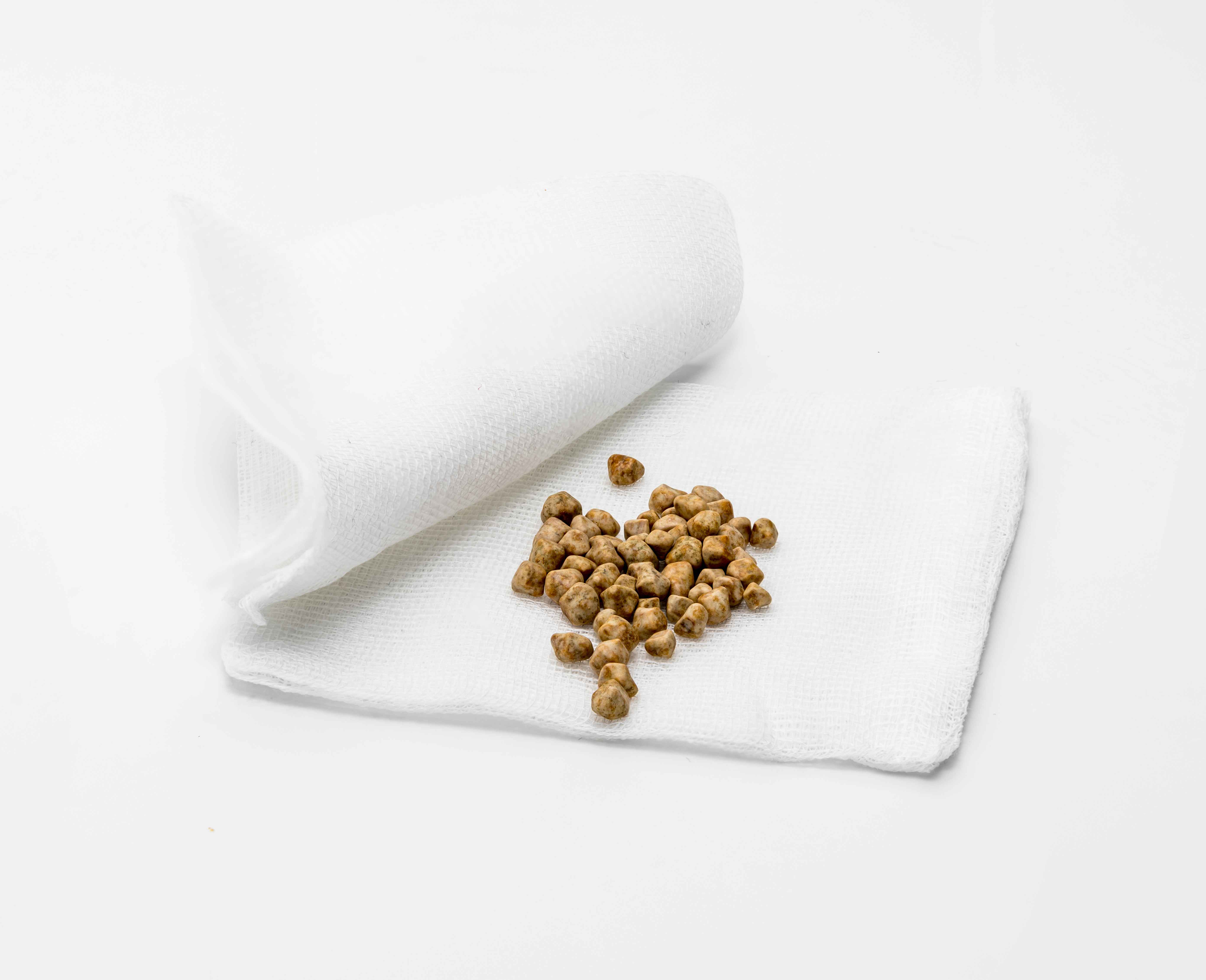 肾结石|结石与饮食有关系?提醒:若不想被肾结石缠上,需养成这些好习惯