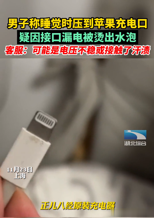 男子被苹果充电口烫伤,原装充电线也漏电,官方客服表示原因较多