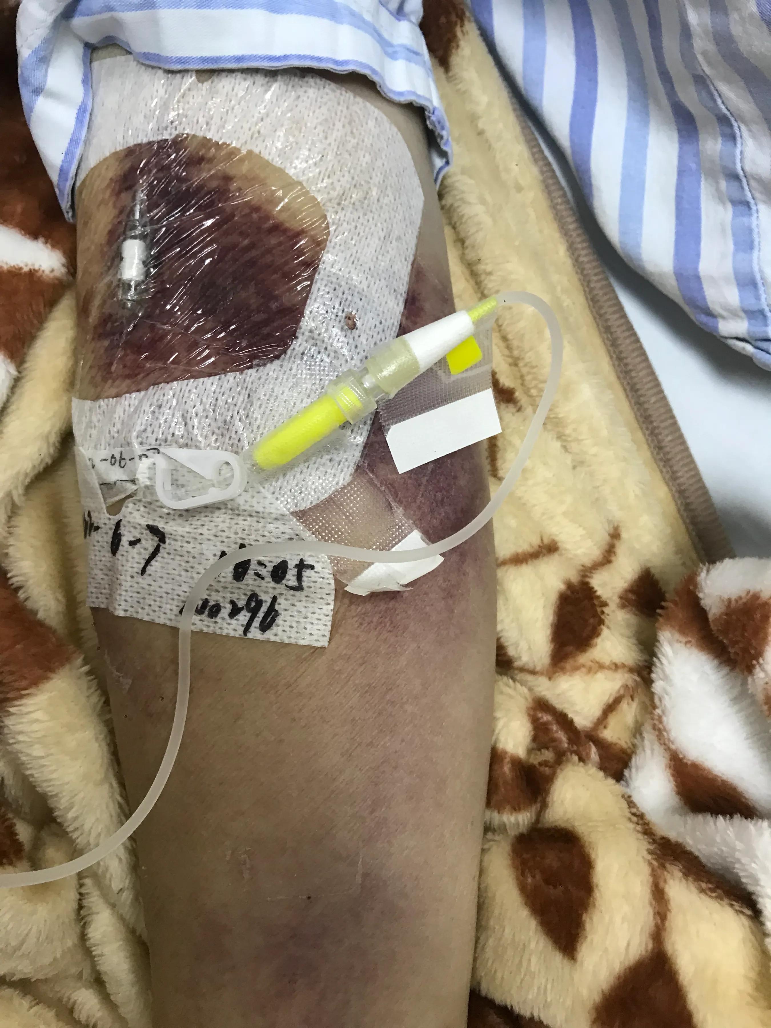 山药|我竭尽全力仍无法阻挡病人走向天堂,这种痛苦你无法体会!