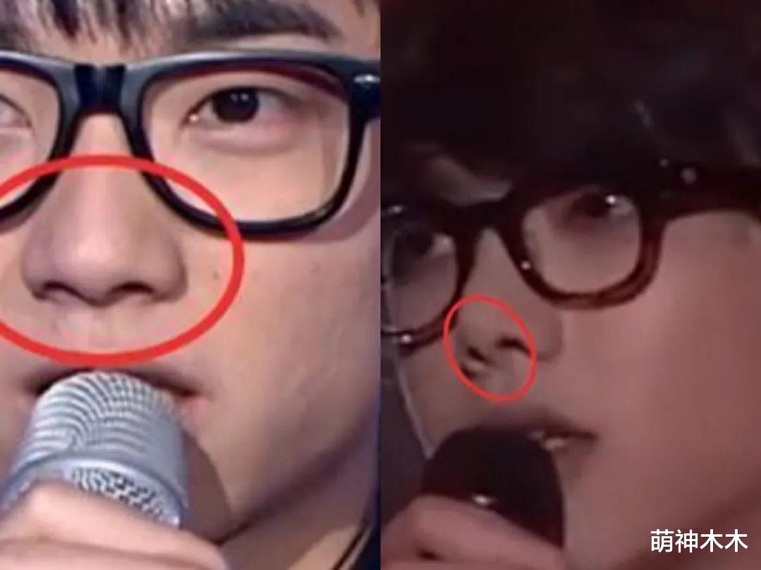 男星也有医美后遗症!华晨宇脸小挂不住肉,王一博法令纹越来越深