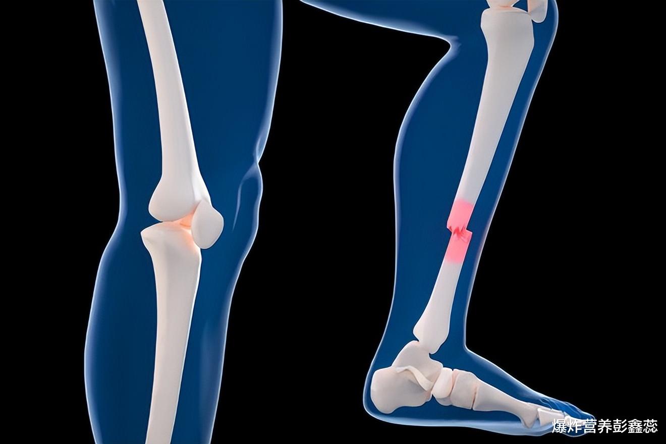 骨密度|经常出现腰酸背痛、全身乏力、驼背等，常吃1种食物，增长骨密度