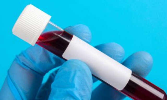 脂肪酸|人若感染艾滋病,多长时间会被发现?可能多数人误认为是皮肤病!